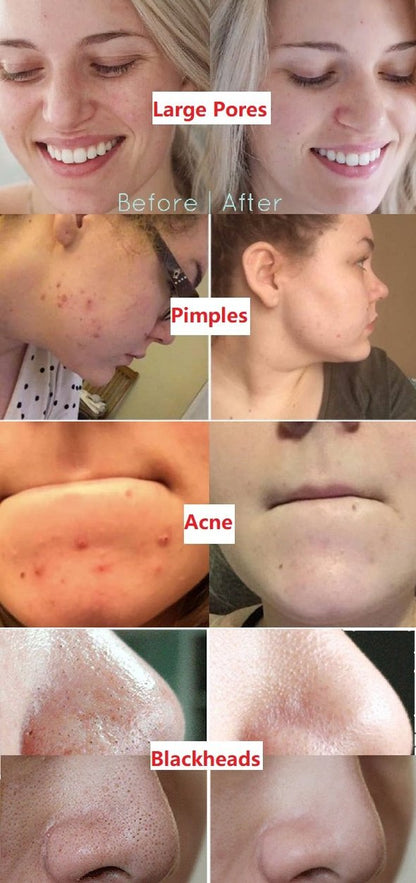 Cougex™  Deep Cleanse Mask Stick