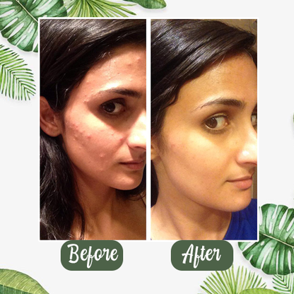 Cougex™  Deep Cleanse Mask Stick
