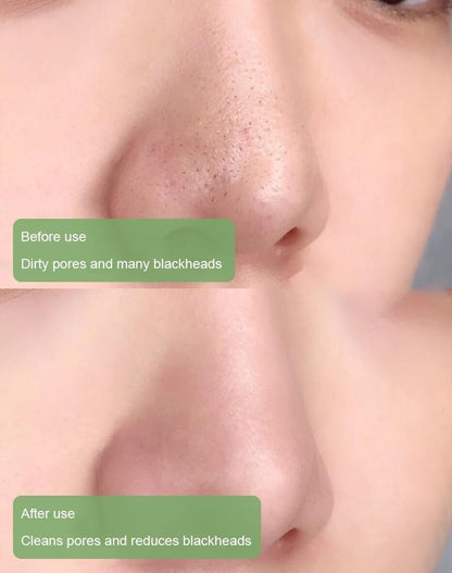 Cougex™  Deep Cleanse Mask Stick